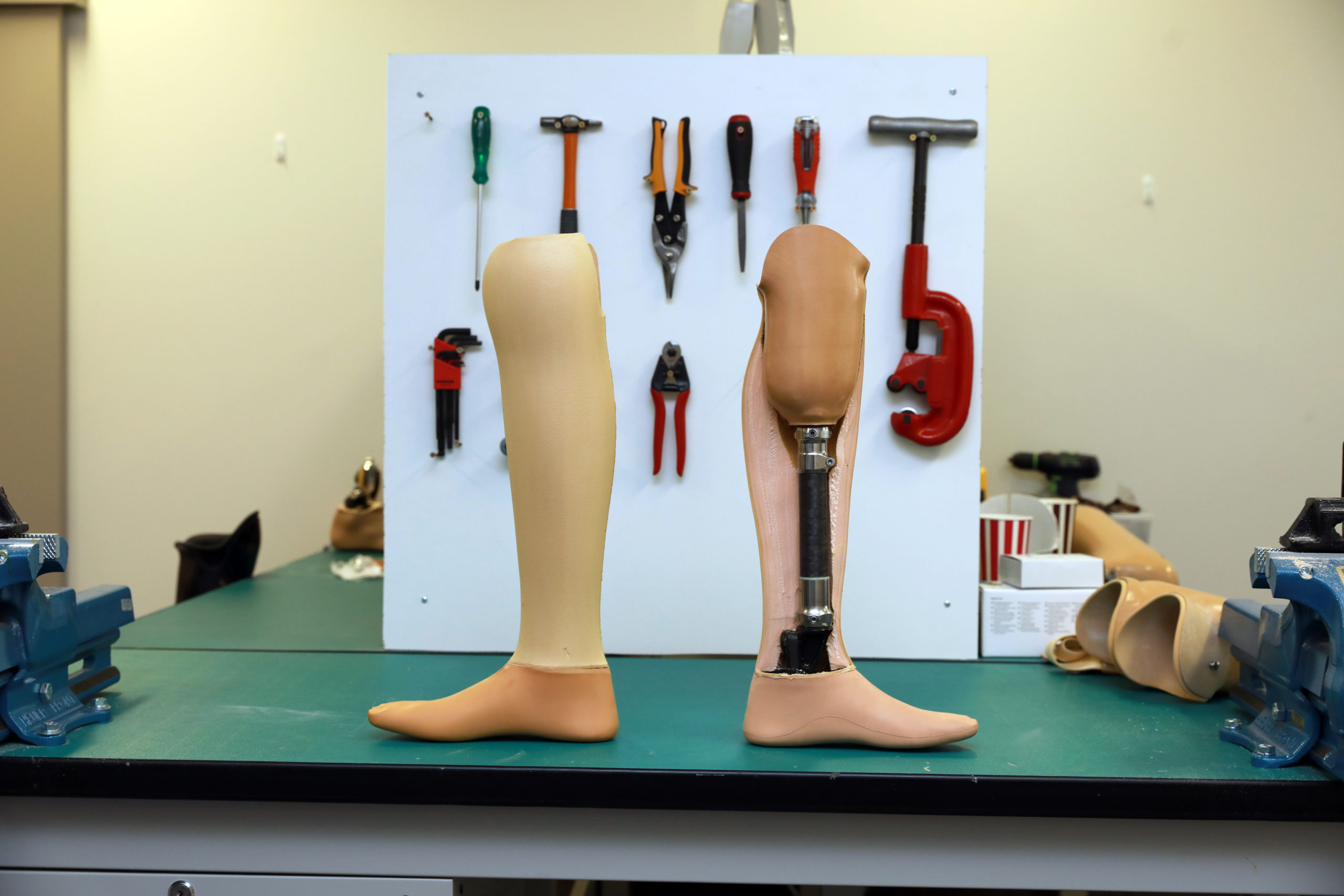 Types of prosthetic legs above the knee