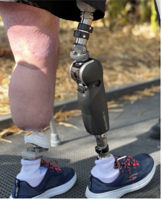 Key parts of below-and above-knee prostheses.