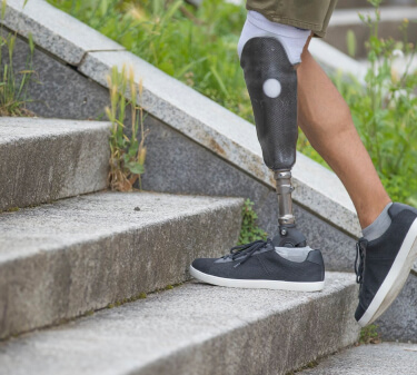 Care for your Prosthesis