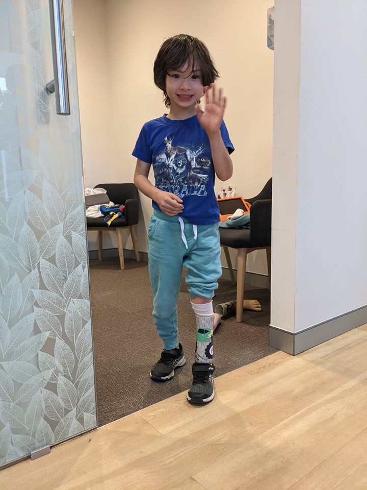 Prosthetics For Kids - Children's Prosthetics | APC Prosthetics