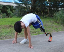 Child running with a prosthetic leg