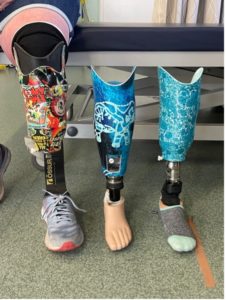 prosthetic legs