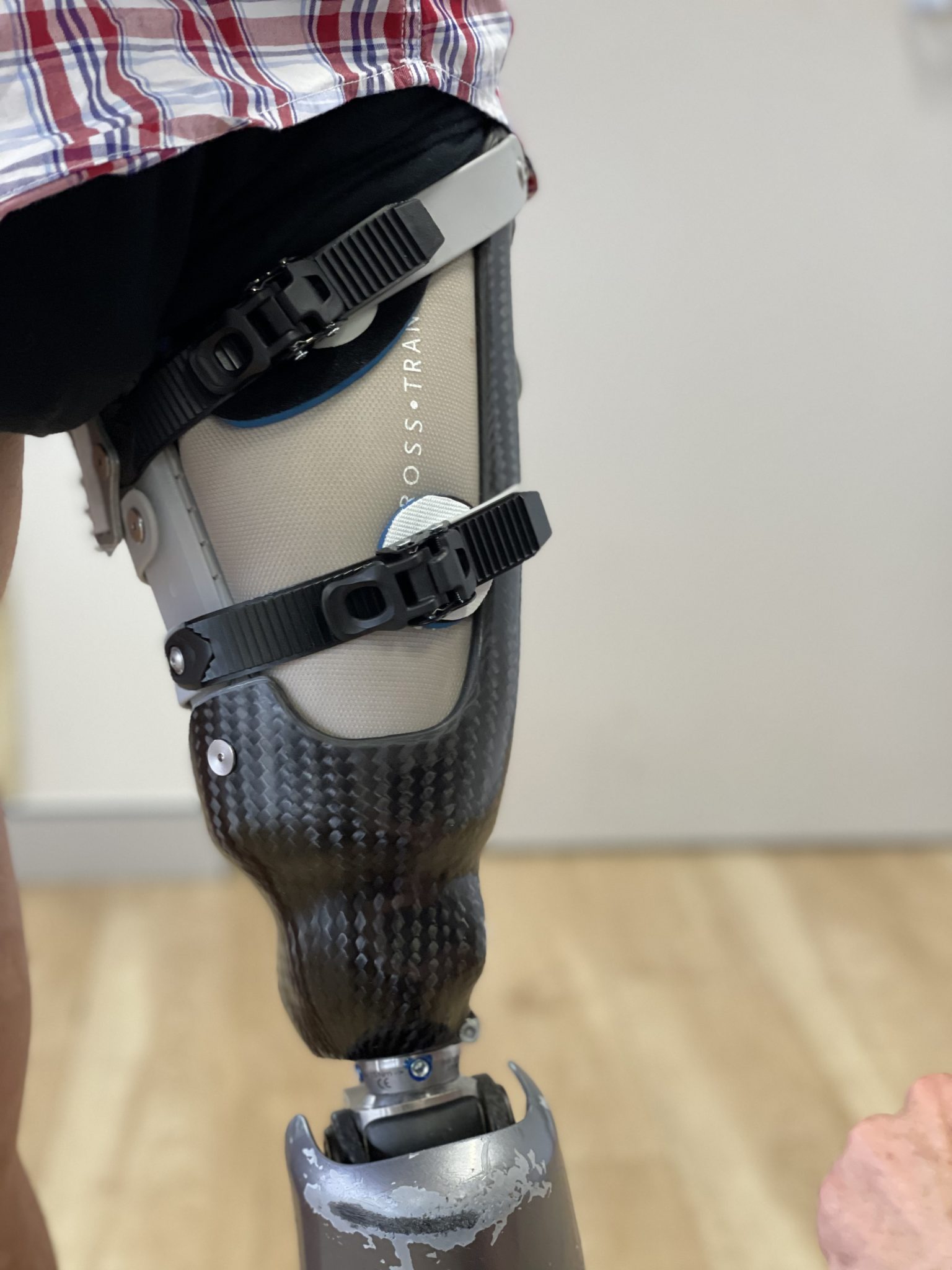 Advanced Prosthetic Knee Solutions | APC Prosthetics