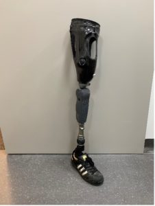 prosthetic knee