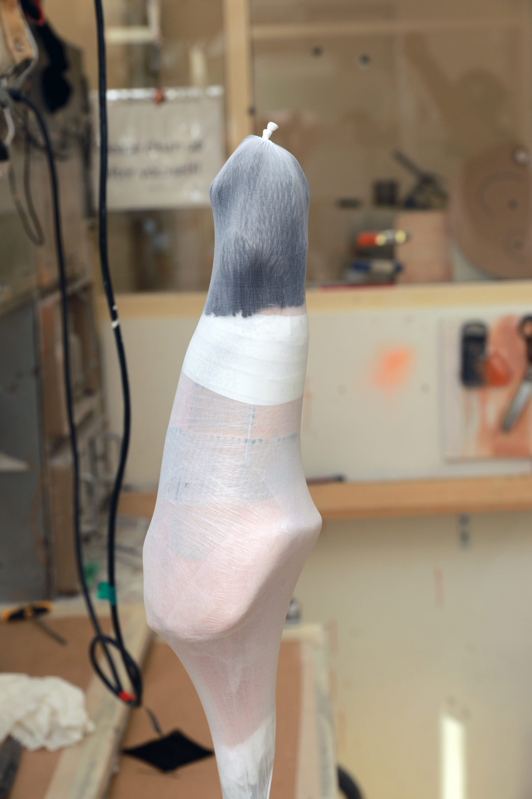 What Materials Are Used For Prosthetics? | APC Prosthetics