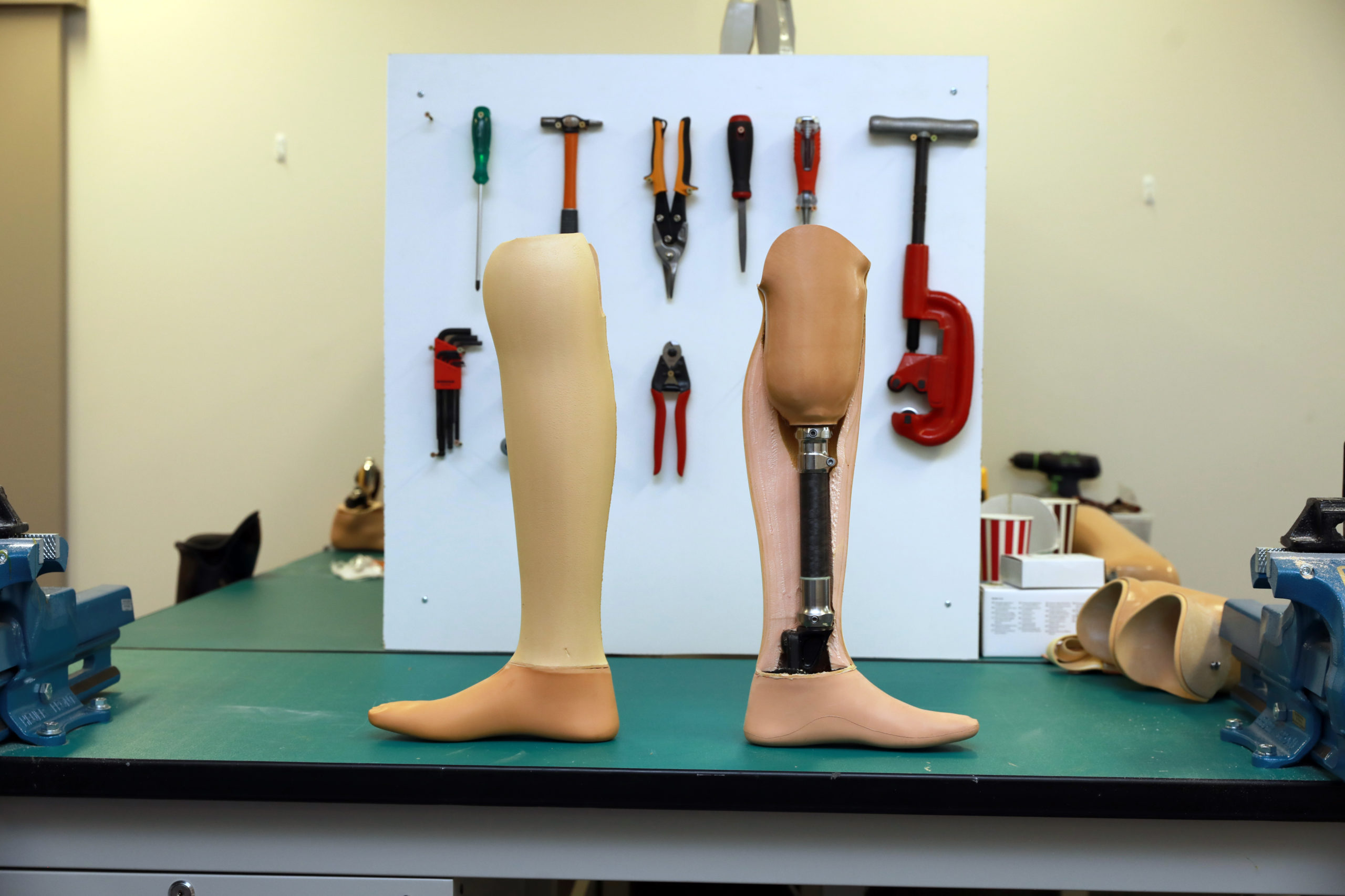 What Materials are Commonly used for Prosthetics?