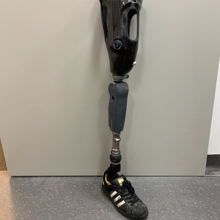The Difference Between Bionics and Prosthetics