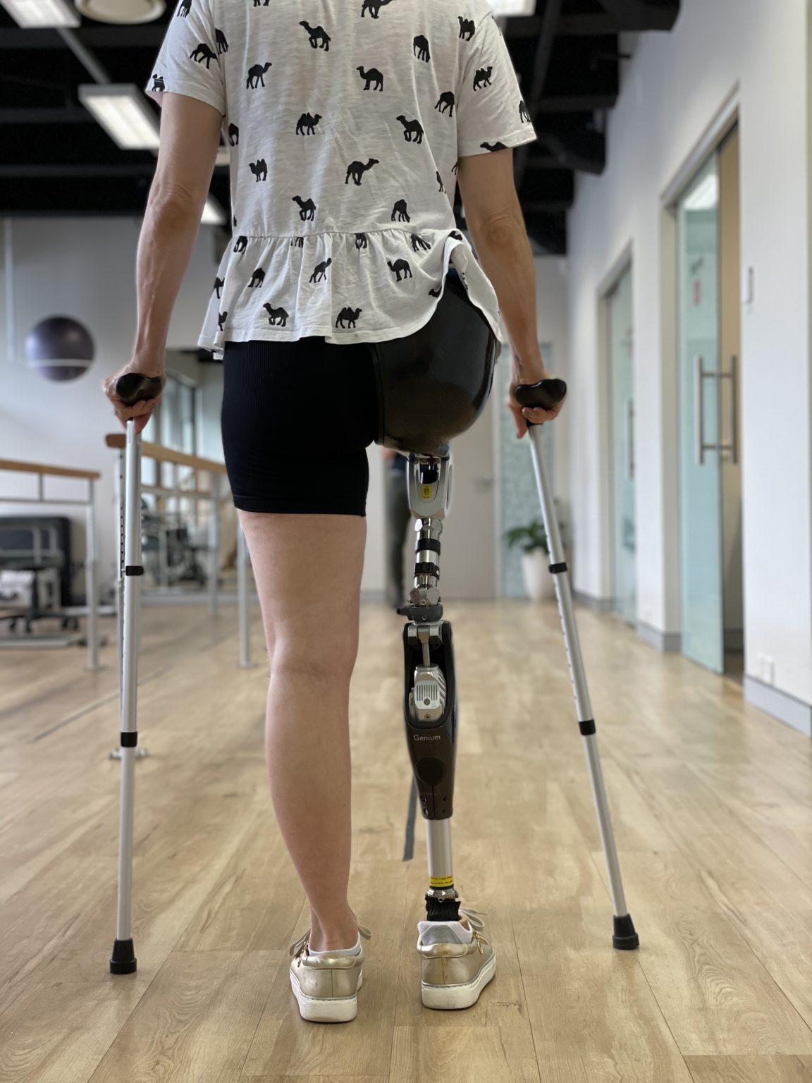 What Are Prosthetics & Bionics? | APC Prosthetics