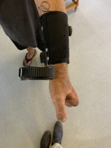 prosthetic wrist device