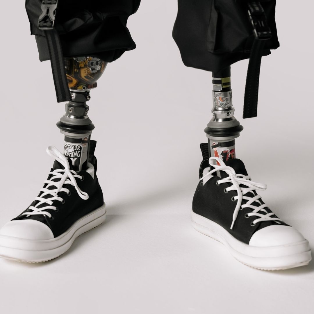 prosthetic limb with converse shoe