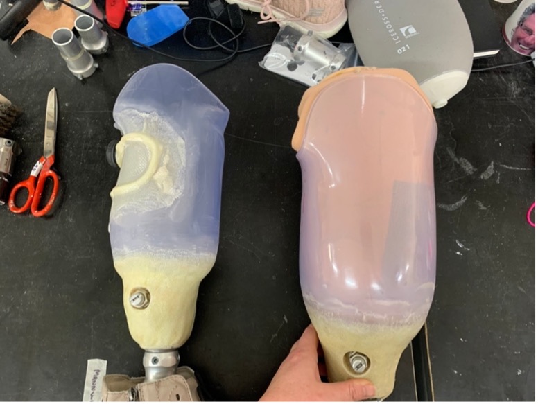Prosthetic interim socket