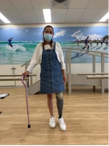client with prosthetic