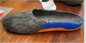 diabetes prosthetic foot option