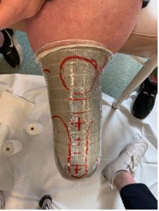 plaster mould for leg