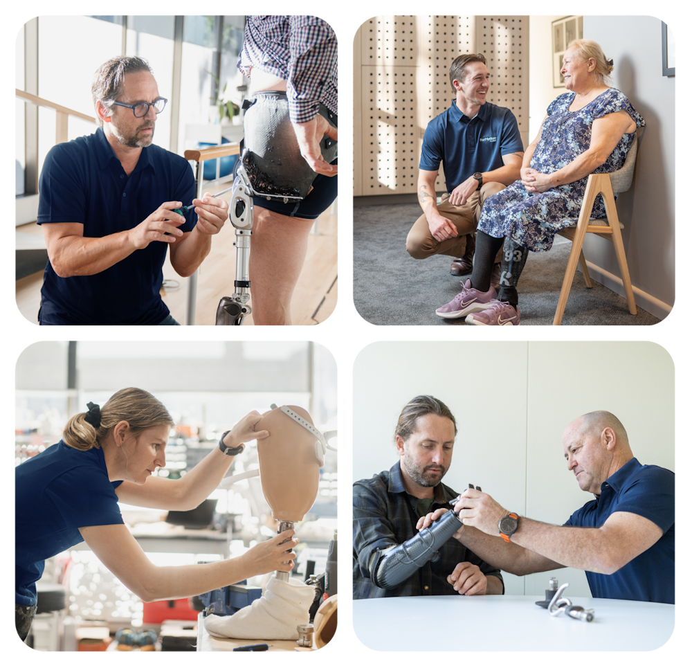 news and events | prosthetics for limbs