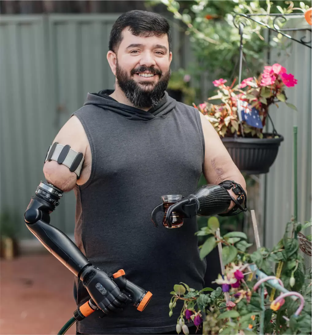artificial arm | prosthetic leg and arm solutions