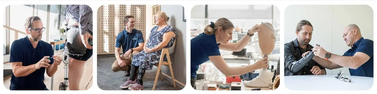 news and events | prosthetics for limbs